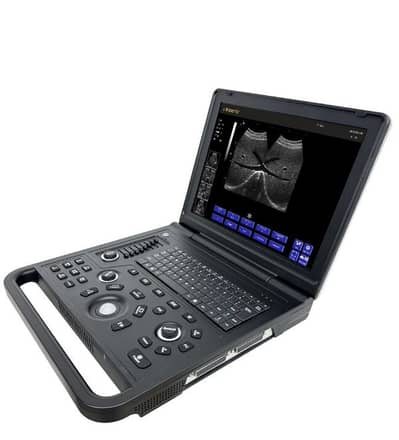Ultrasound B/W - Laptop with battery